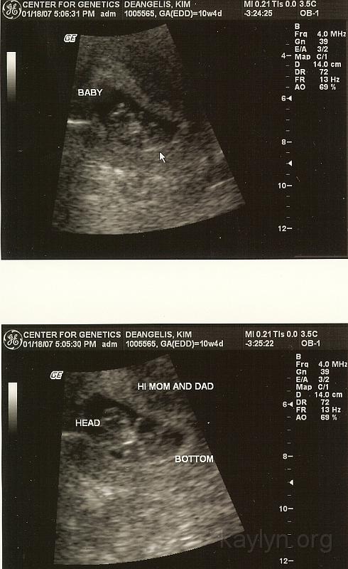 fetus 011807.jpg